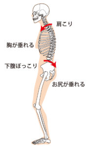 反り腰のお悩みは意外に多いですよね 札幌 整体 手結整体